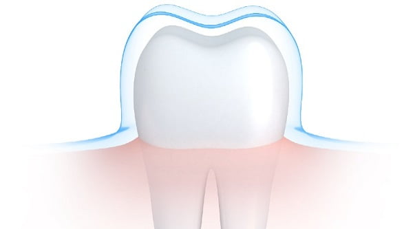 Dişler hakkında 5 şaşırtıcı gerçek